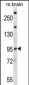 NEDD4L Antibody (Center)